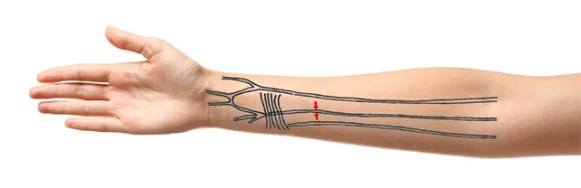 1649942694584085293.jpg evolutionary-angle-humans-are-developing-extra-arteries-in-the-forearm-picture-1-Jgl80aFkk.jpg