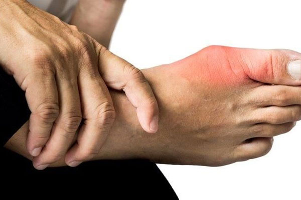 1650905093951047167.jpg diet-for-people-with-gout-what-to-eat-what-to-abstain-to-treat-effectively-picture-1-RwxedzCrR.jpg